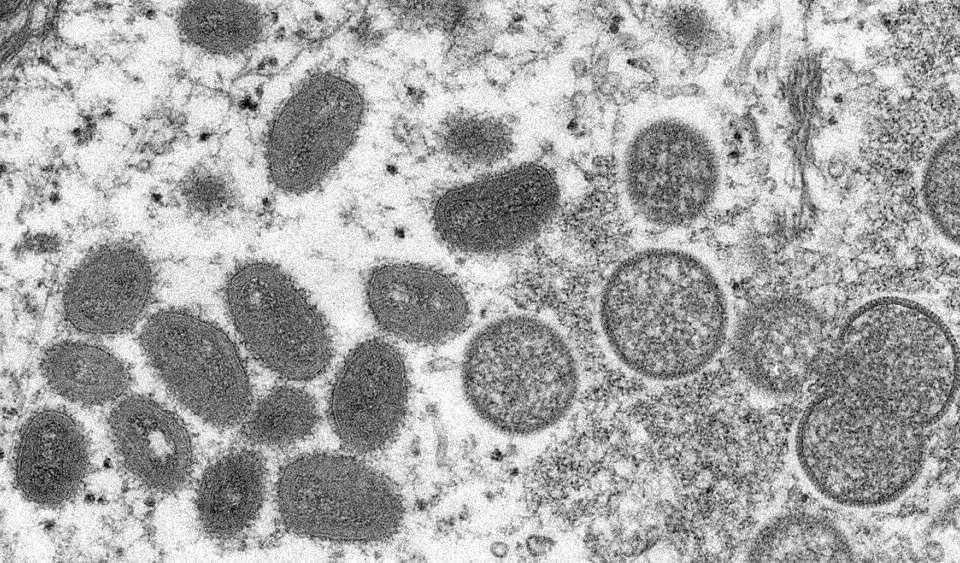You are currently viewing Vacina contra a varíola dos macacos deve chegar ao Brasil este mês