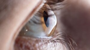 Read more about the article Dia Mundial do Ceratocone: doença ocular é responsável por maior parte dos transplantes de córnea no país
