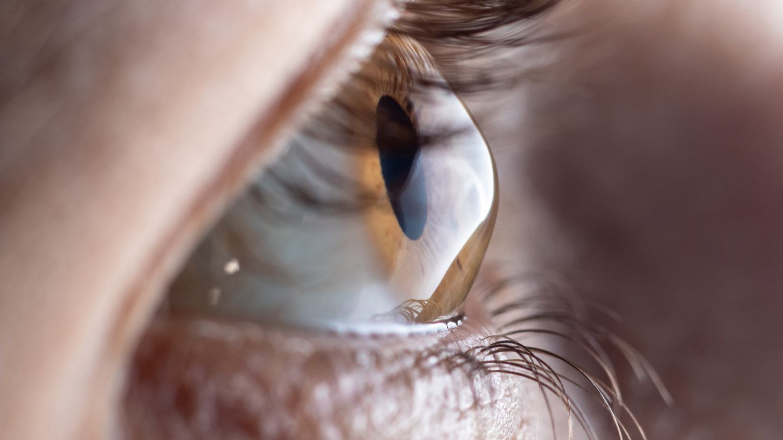 You are currently viewing Dia Mundial do Ceratocone: doença ocular é responsável por maior parte dos transplantes de córnea no país